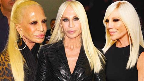 foto donatella versace 2018|donatella versace face what happened.